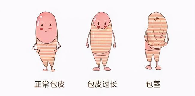 儿童包皮一定要切吗,天行官方网站